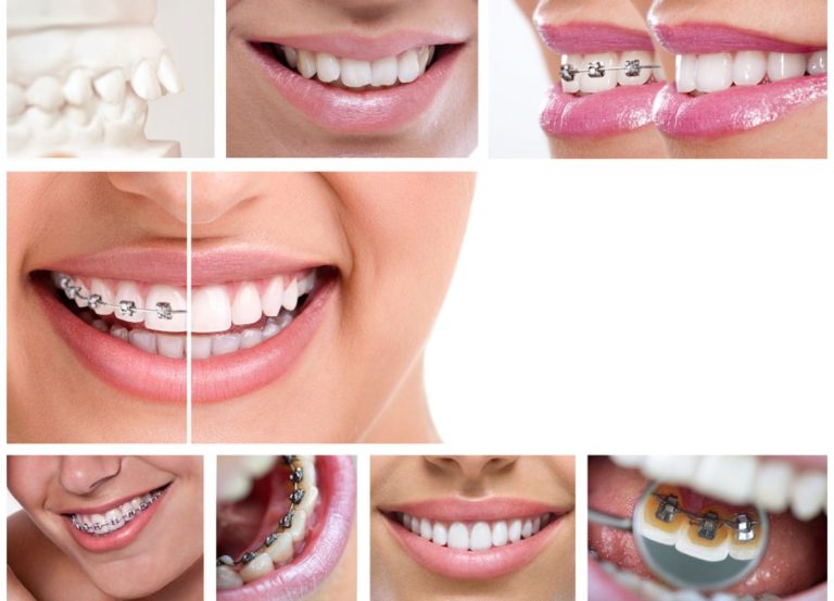 Trauma-Informed Dental Care: What Patients With Bad Past Experiences Should Look For